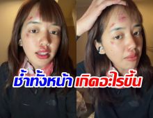 เเฟนๆห่วง พลอยไพลิน หน้าช้ำหลังกลับจากทริปแอนตาร์กติกา